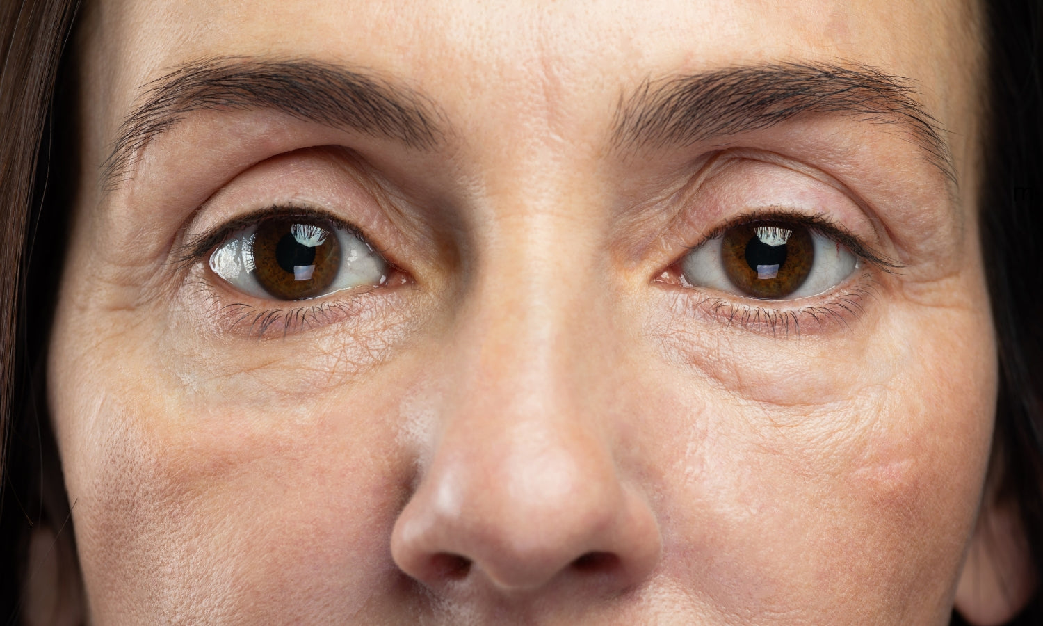 Fix Droopy Eyes & Aging Skin Caused By Weak Facial Muscles